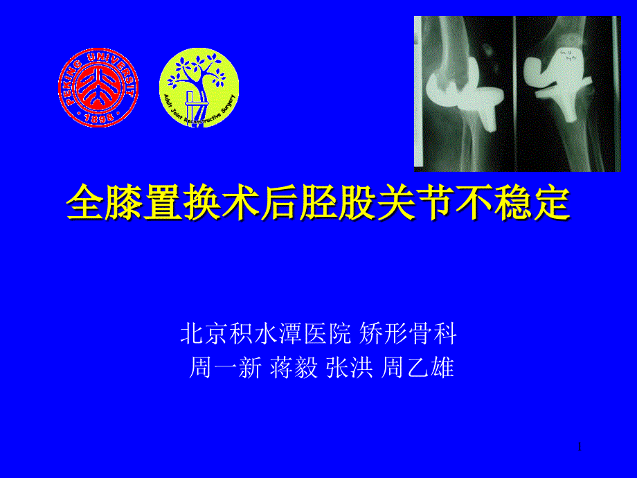 全膝置换术后胫股关节不稳定参考PPT_第1页