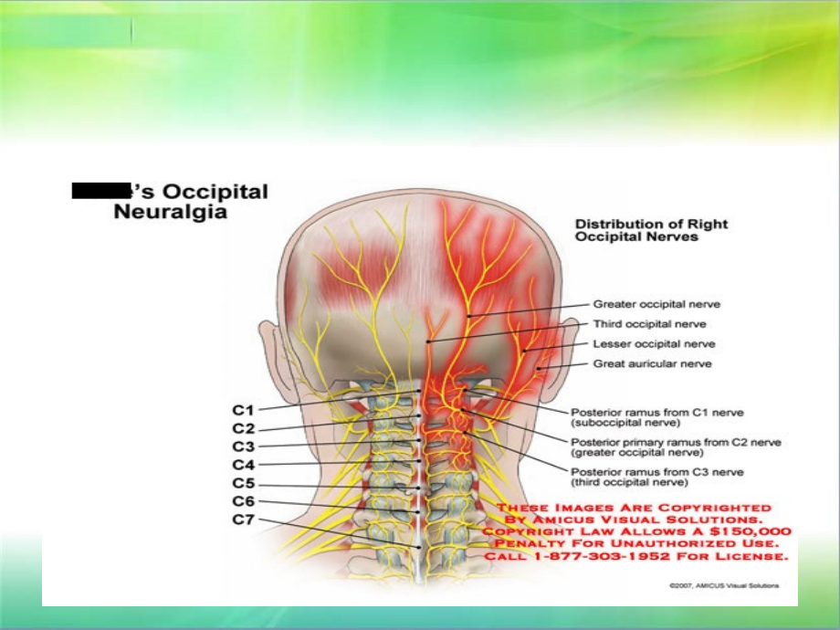 颈椎病的MRI诊断75740_第4页