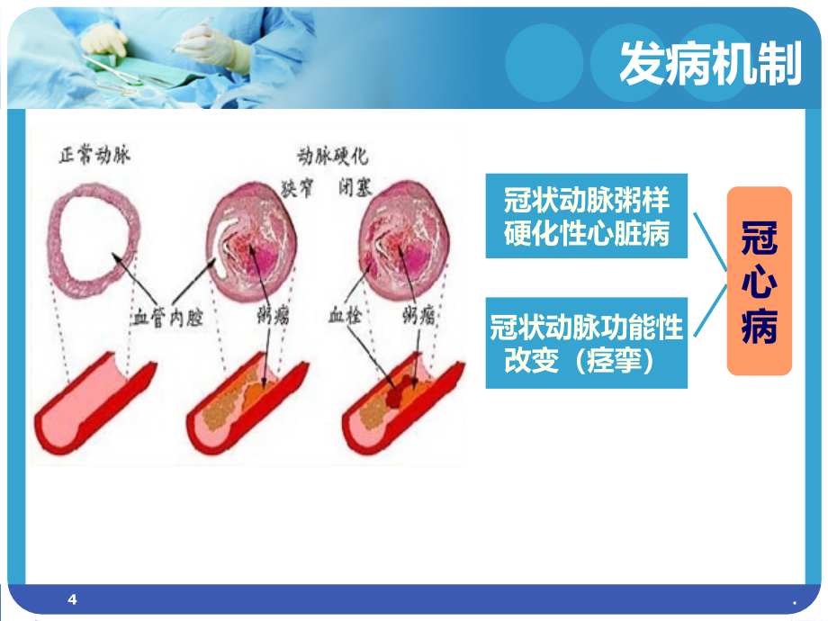 内科护理学冠心脏PPT课件_第4页