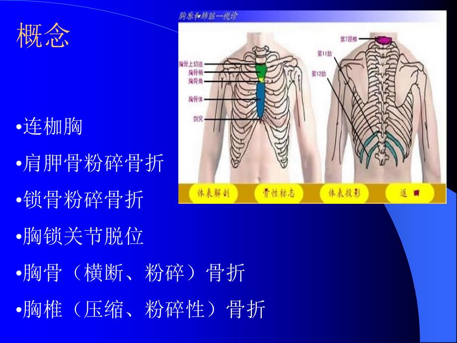 严重胸廓创伤的修复参考PPT_第4页