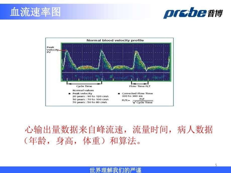 法国ATYS公司无创血液动力学监护仪介绍参考PPT_第5页