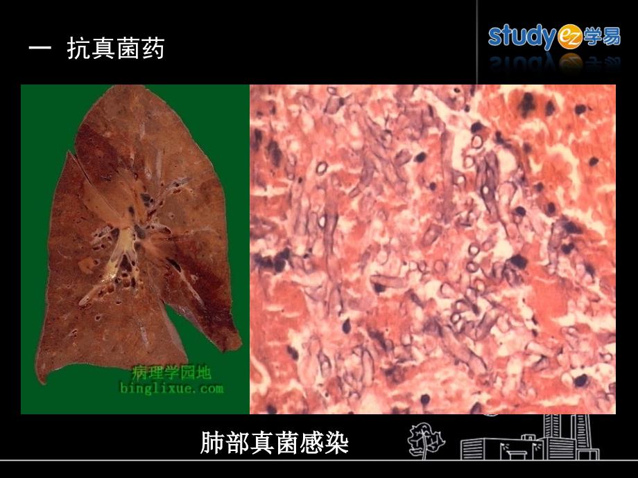 抗真菌药与抗病毒药参考PPT_第4页