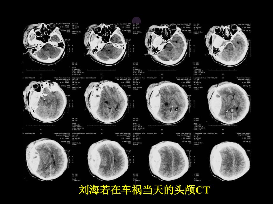 全科医师康复医学概论参考PPT_第4页