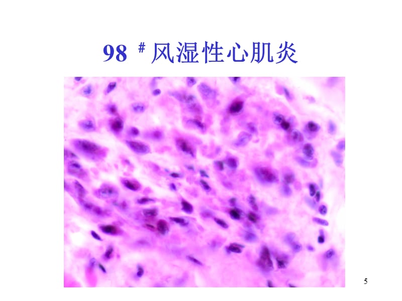 病理学1心血管系统疾病参考课件_第5页