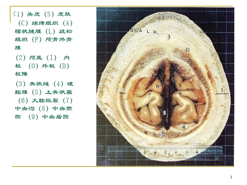 人体断层解剖图谱大脑参考PPT_第3页