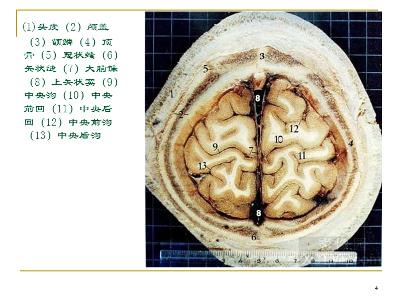人体断层解剖图谱大脑参考PPT_第4页