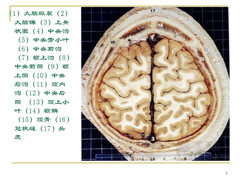 人体断层解剖图谱大脑参考PPT_第5页