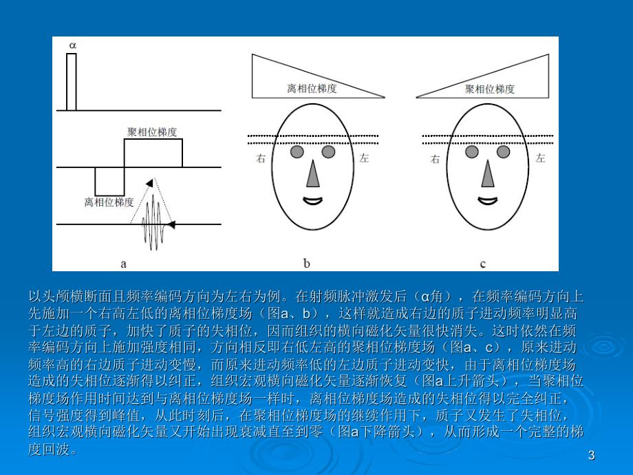 GRE梯度回波序列的原理与临床参考PPT_第3页