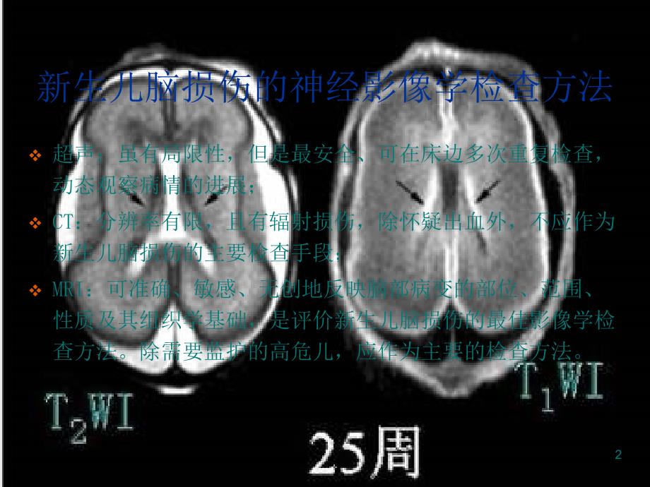 生儿缺氧缺血或窒息所致脑损伤的影像学诊断_第2页