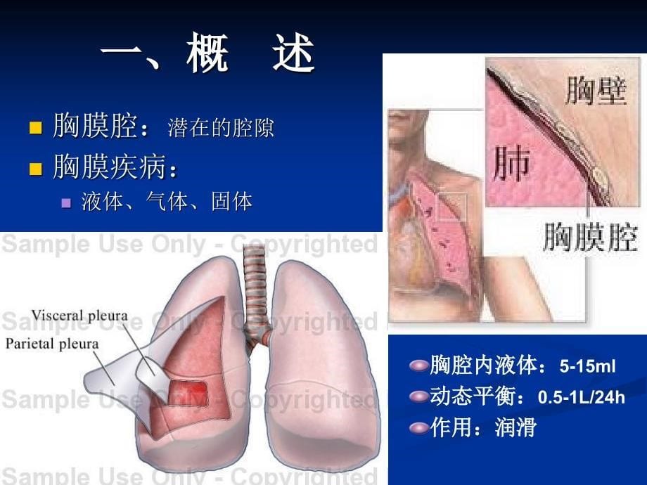 《胸腔积液》精选_第5页