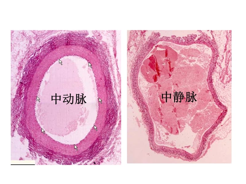 《用静脉血管》演示PPT_第3页