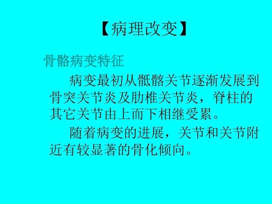 强直性脊柱炎89222_第5页