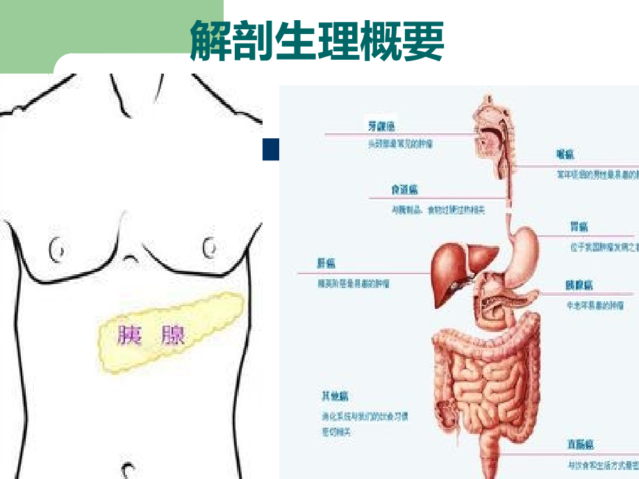 急性胰腺炎病人的护理13375_第3页