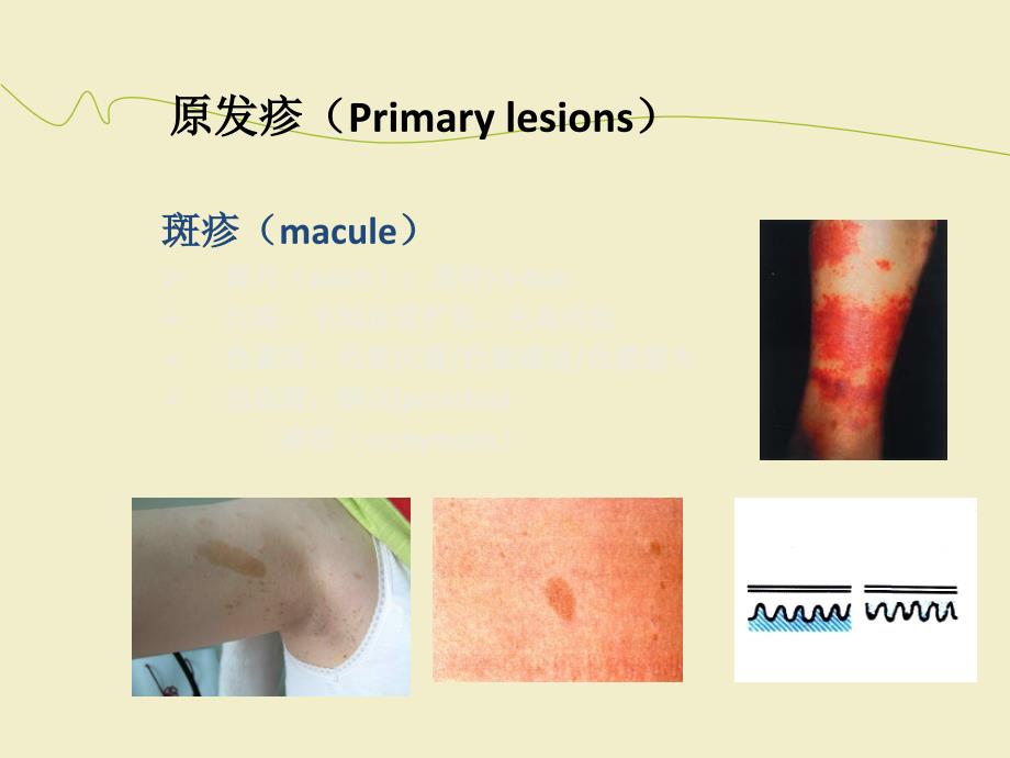 皮肤病的诊断与治疗PPT课件01_第4页