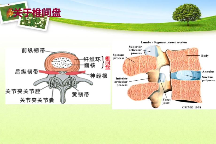 腰椎间盘突出症完整版PPT1230_第4页