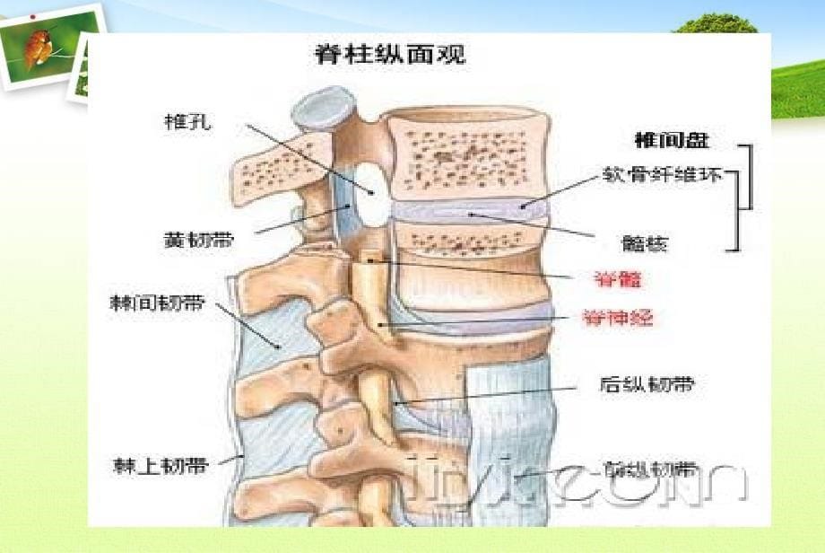 腰椎间盘突出症检查方法PPT课件123_第5页