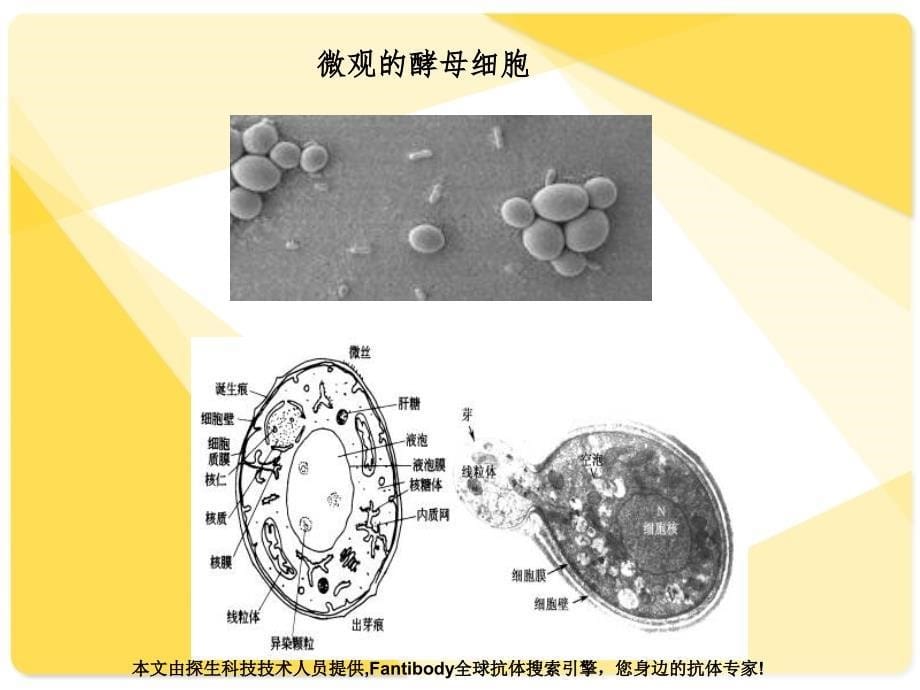 表达产物的SDS聚丙烯酰胺凝胶电泳分离分析鉴定PPT课件_第5页