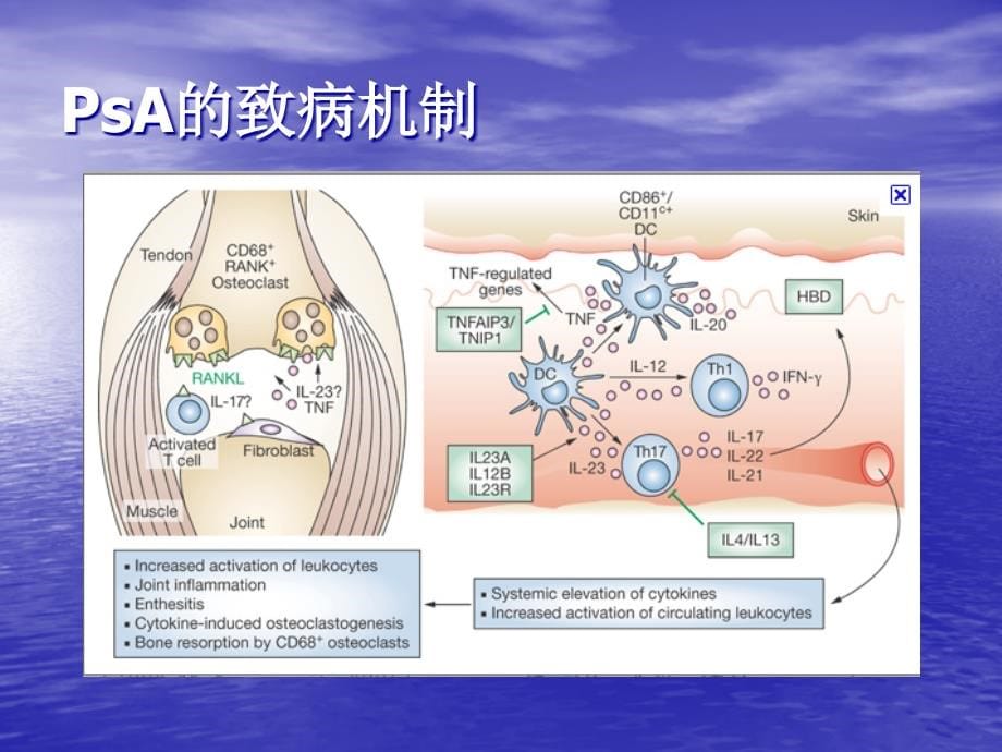 银屑病关节炎诊治指南PPT课件123_第5页