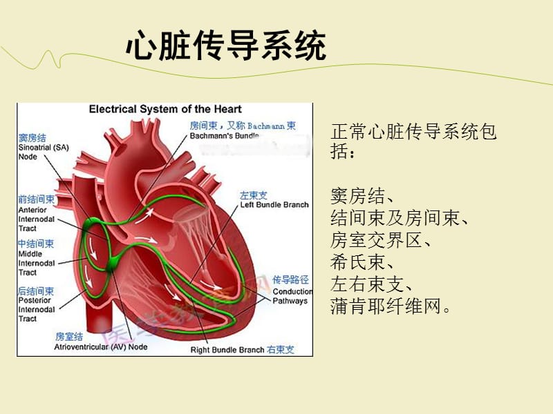 永久心脏起搏器植入术--护理查房PPT课件123_第5页