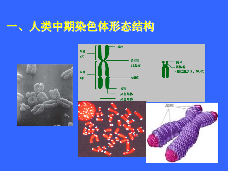 2染色体异常与疾病_第4页