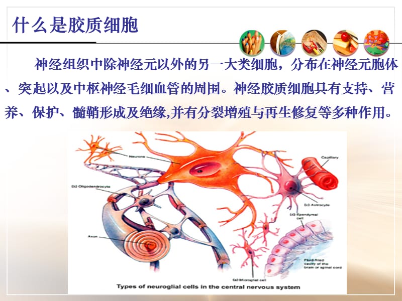 中枢神经系统肿瘤医学课件_第5页