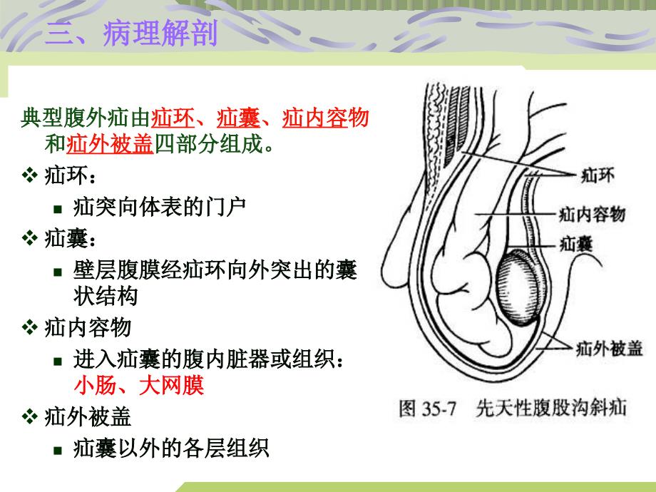 腹外疝病人的护PPT课件_第4页