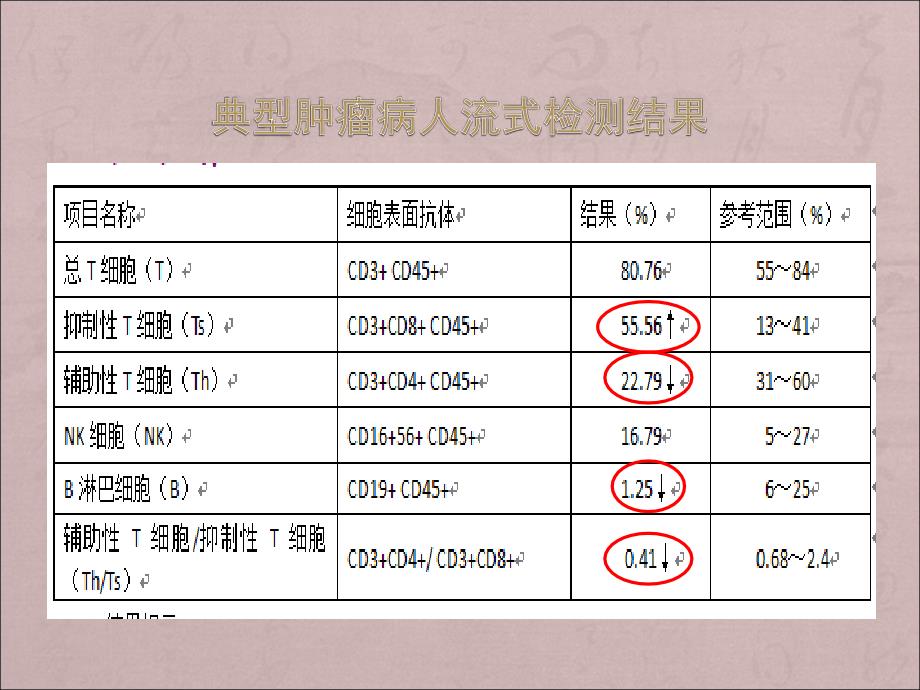 淋巴细胞亚群与肿瘤预后关系PPT课件012_第4页