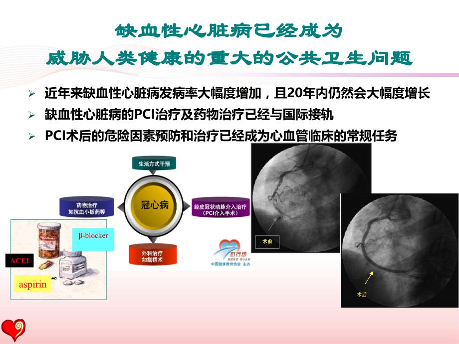 PCI术后患者的心脏康复--指南与现实(2016盛京会)ppt课件_第3页