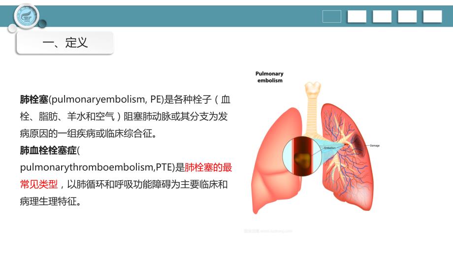 一例肺栓塞患者的护理查房ppt课件_第4页