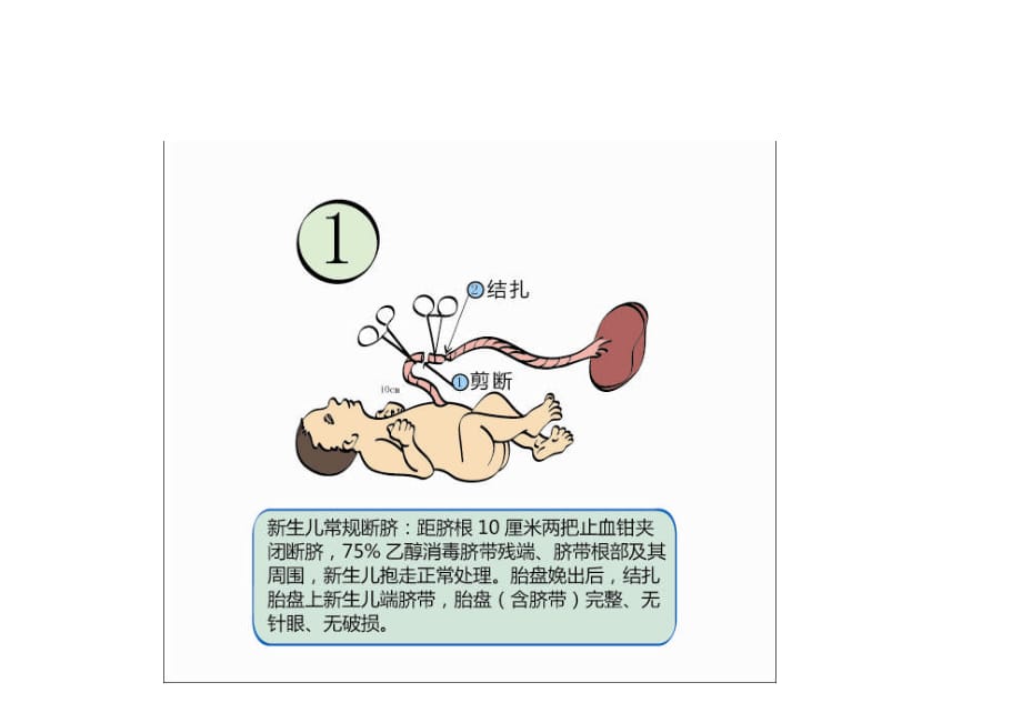 脐带胎盘干细胞采集流程_第3页