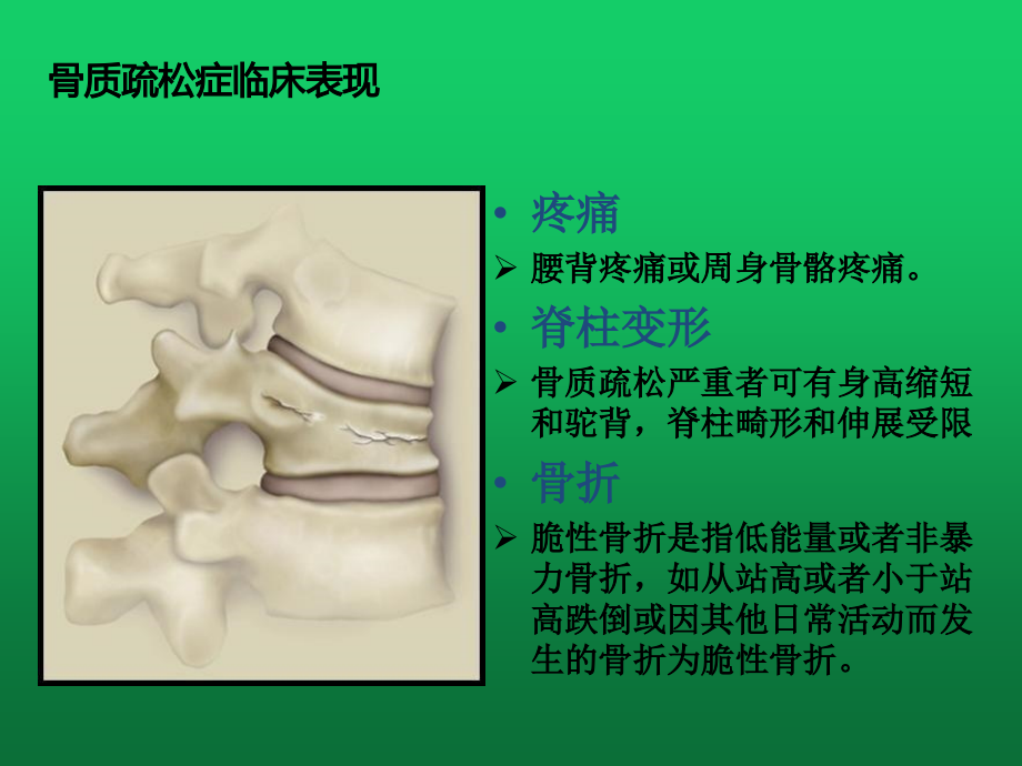 骨质疏松症与椎体压缩性骨折_第4页