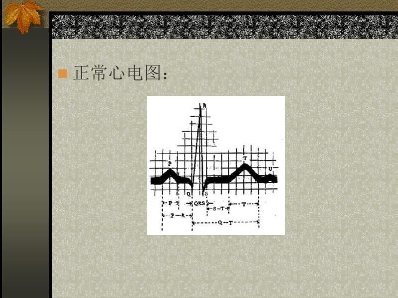 药物对哇巴因诱发豚鼠心律失常的保护作用_第5页