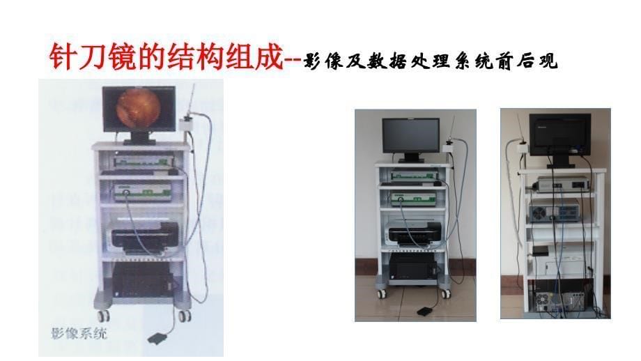 针刀镜技术_第5页