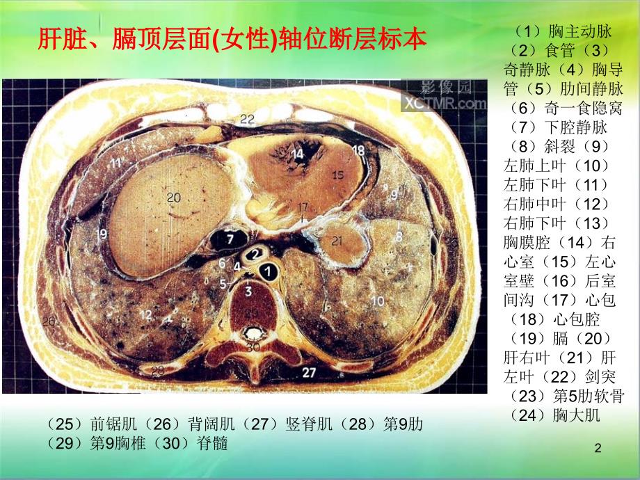 （优质医学）腹部断层解剖和断层CT(精品)_第2页