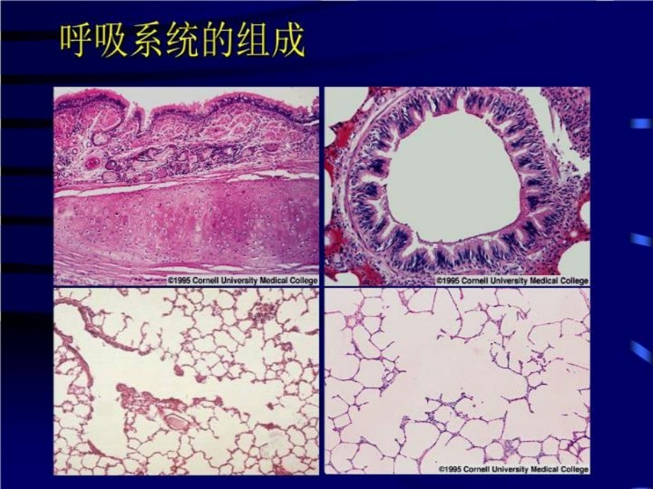 呼吸系统疾病18672 PPT课件_第4页