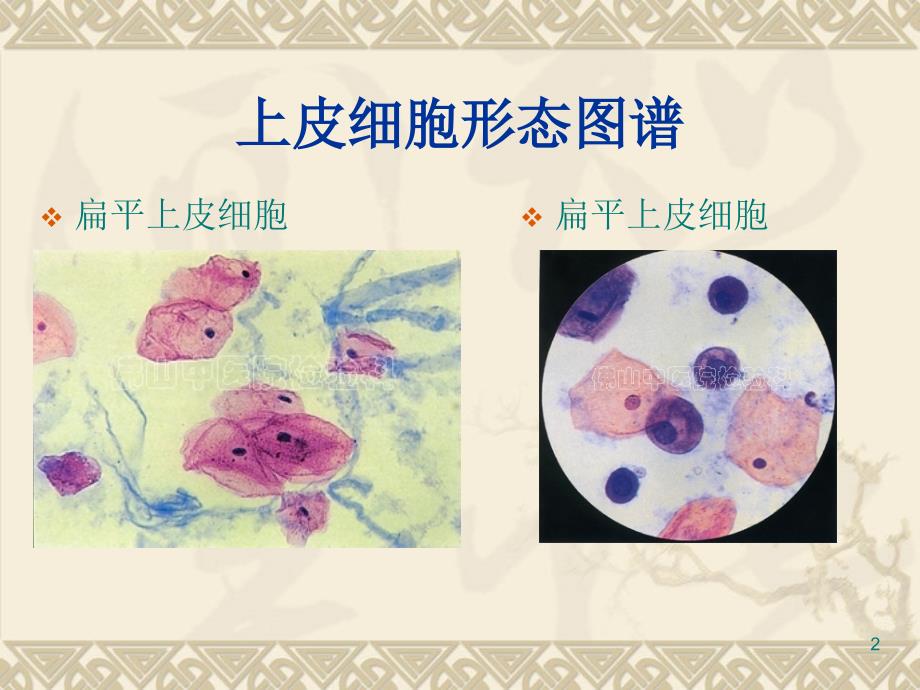 (优质医学)尿沉渣图片_第2页