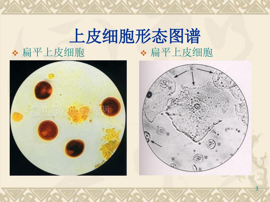 (优质医学)尿沉渣图片_第3页