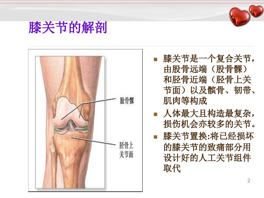 （优质医学）人工全膝关节置换术后护理_第2页