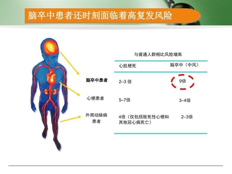 （优质医学）脑卒中的识别与预防_第5页