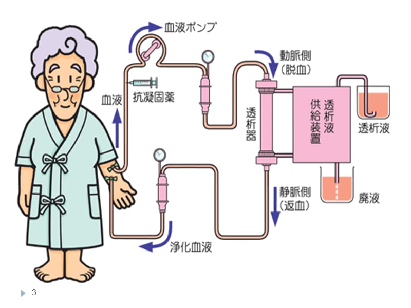 （优质医学）可调钠在血液透析中的应用_第3页