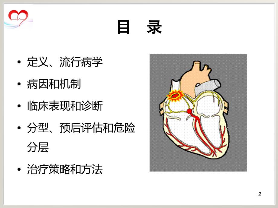 （优质医学）室性早搏治疗指南_第2页