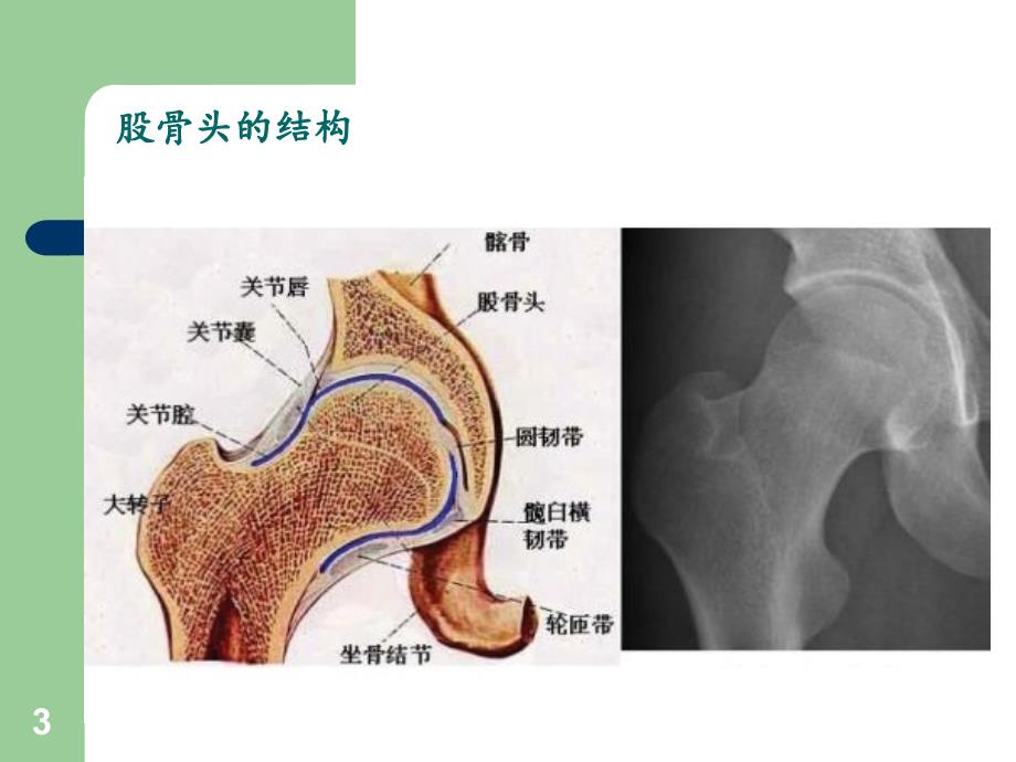 （优质医学）股骨头坏死诊治原则_第3页