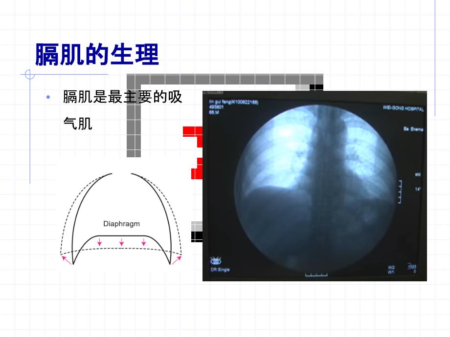 膈肌超声评估PPT课件_2_第3页