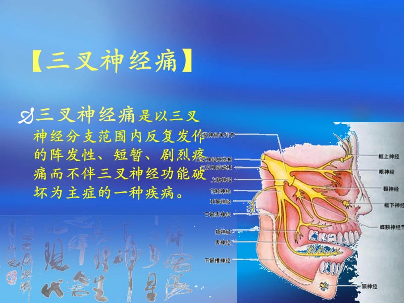 三叉神经痛_中医论治PPT课件123_第2页