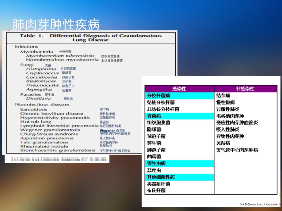 肺肉芽肿性炎和结核诊断指南lxy2018PPT课件_第4页