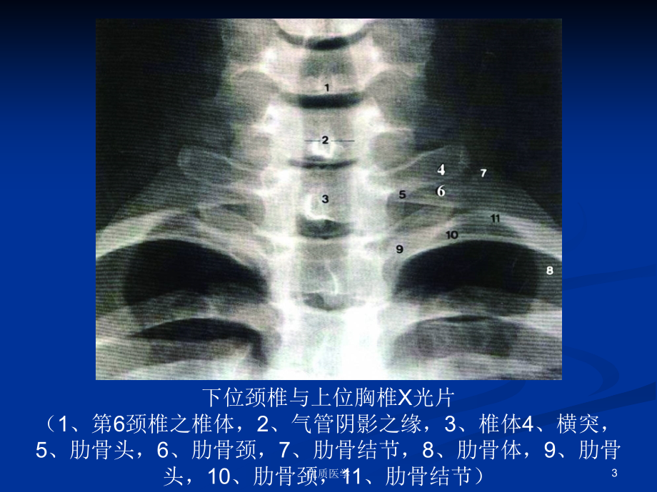 脊柱的影像学诊断[特选材料]_第3页