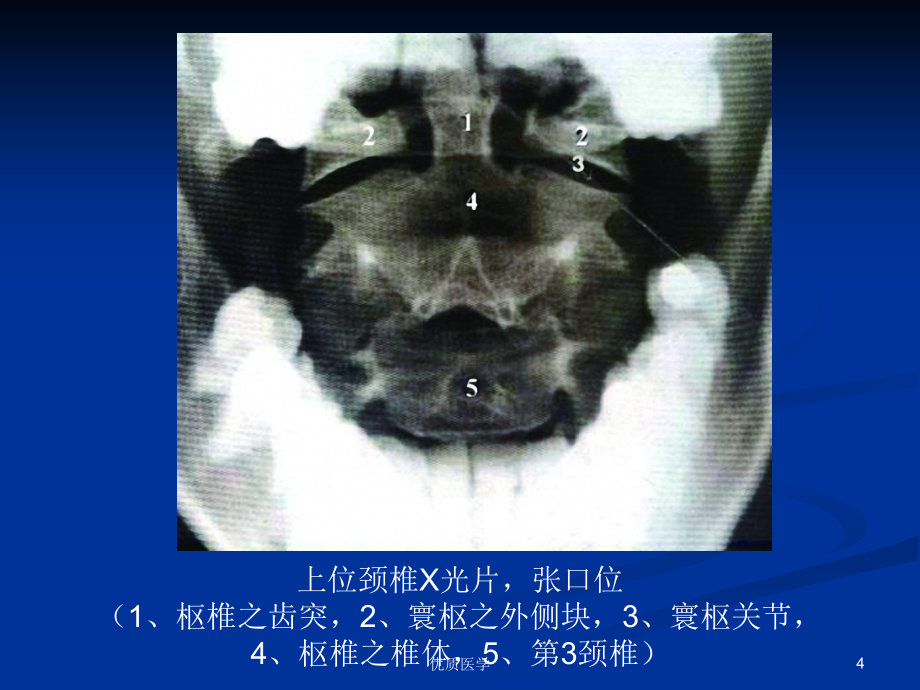 脊柱的影像学诊断[特选材料]_第4页