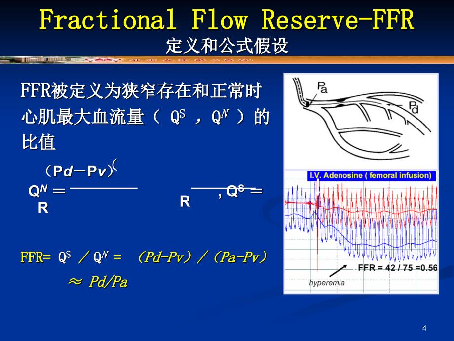 阜外-FFR原理及临床应用_第4页