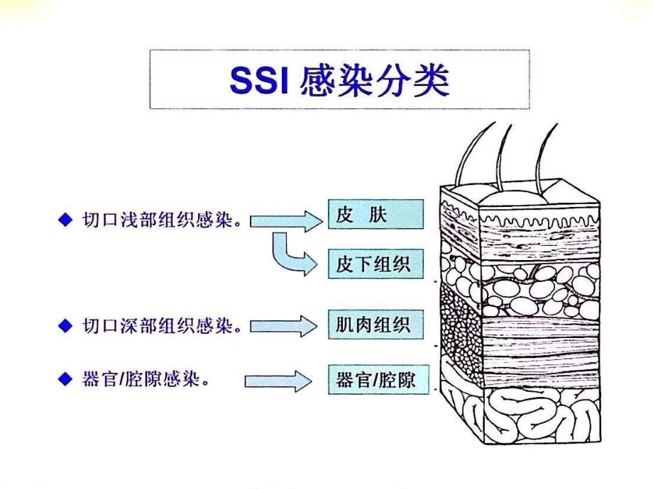 手术部位感染预防与控制PPT课件012_第3页