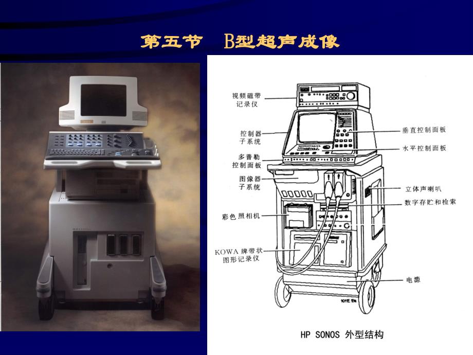 B超超声设备成像原理培训讲义_第4页